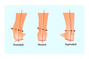 Causes and Treatment of Supination