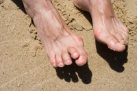Description of Hammertoe