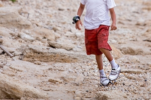 Various Congenital Foot Conditions